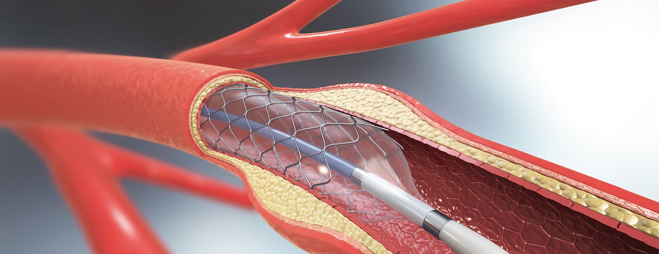 Professional Obesity Surgery Operations Accompanied by Expert Doctors at Ibni Sina Health.